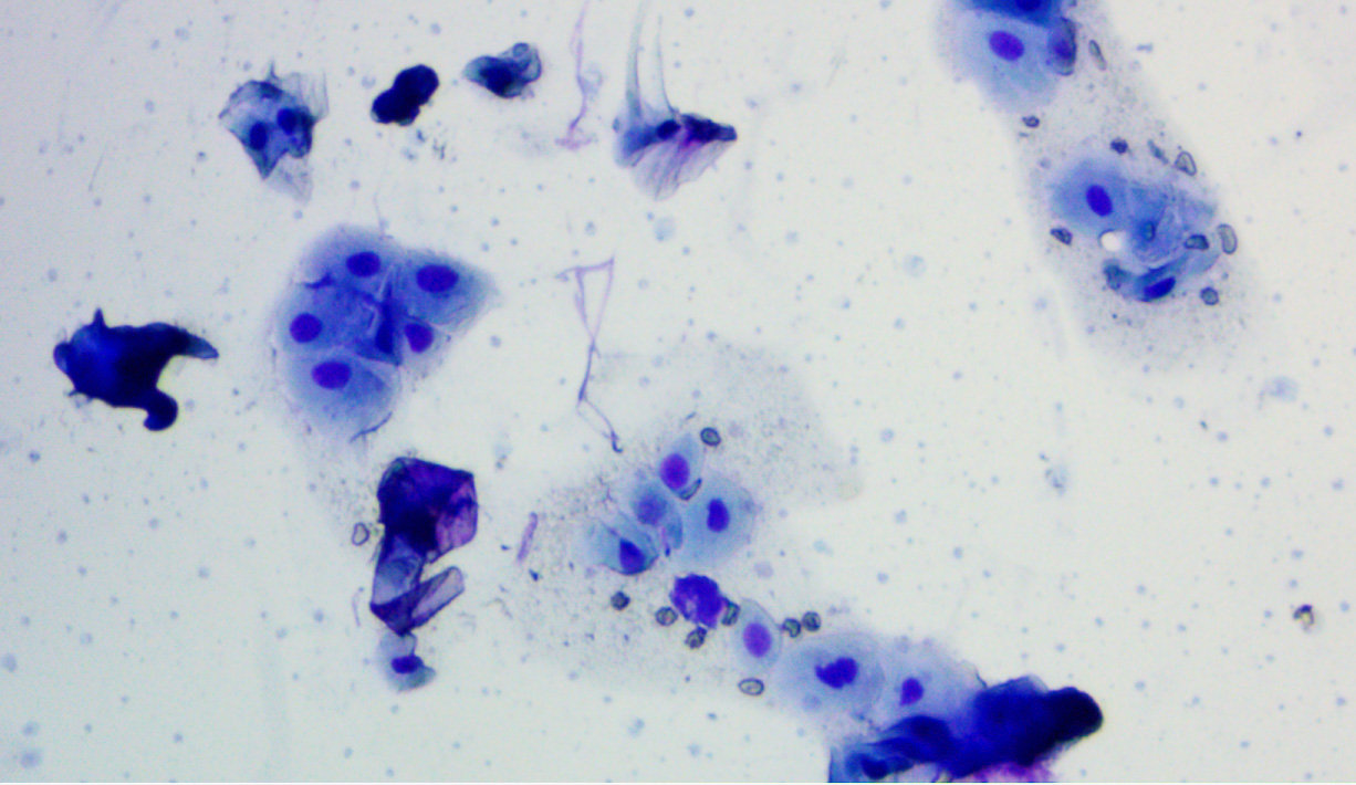 Vaginal Cytology smear looking for cornification