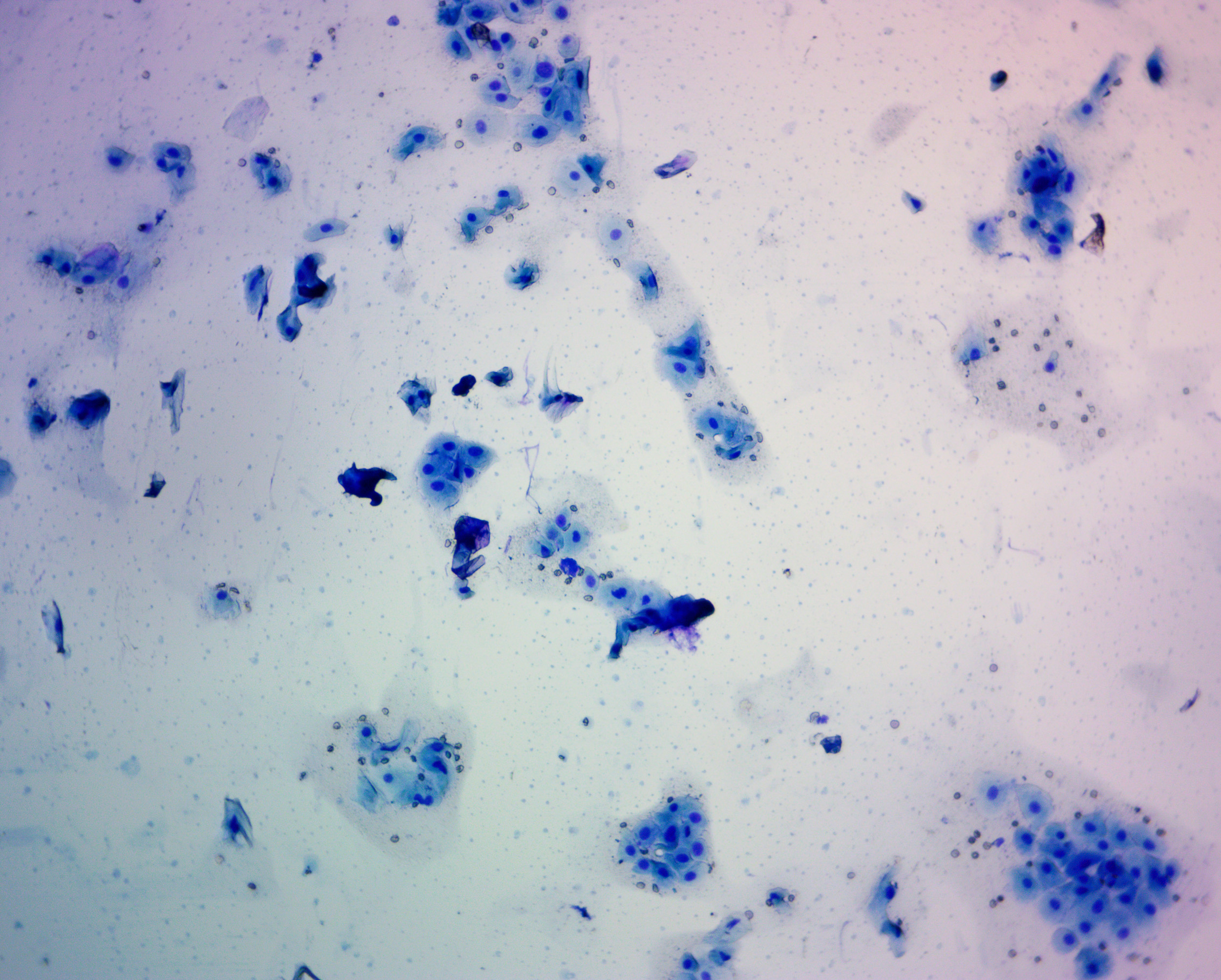 Vaginal Cytology smear looking for cornification