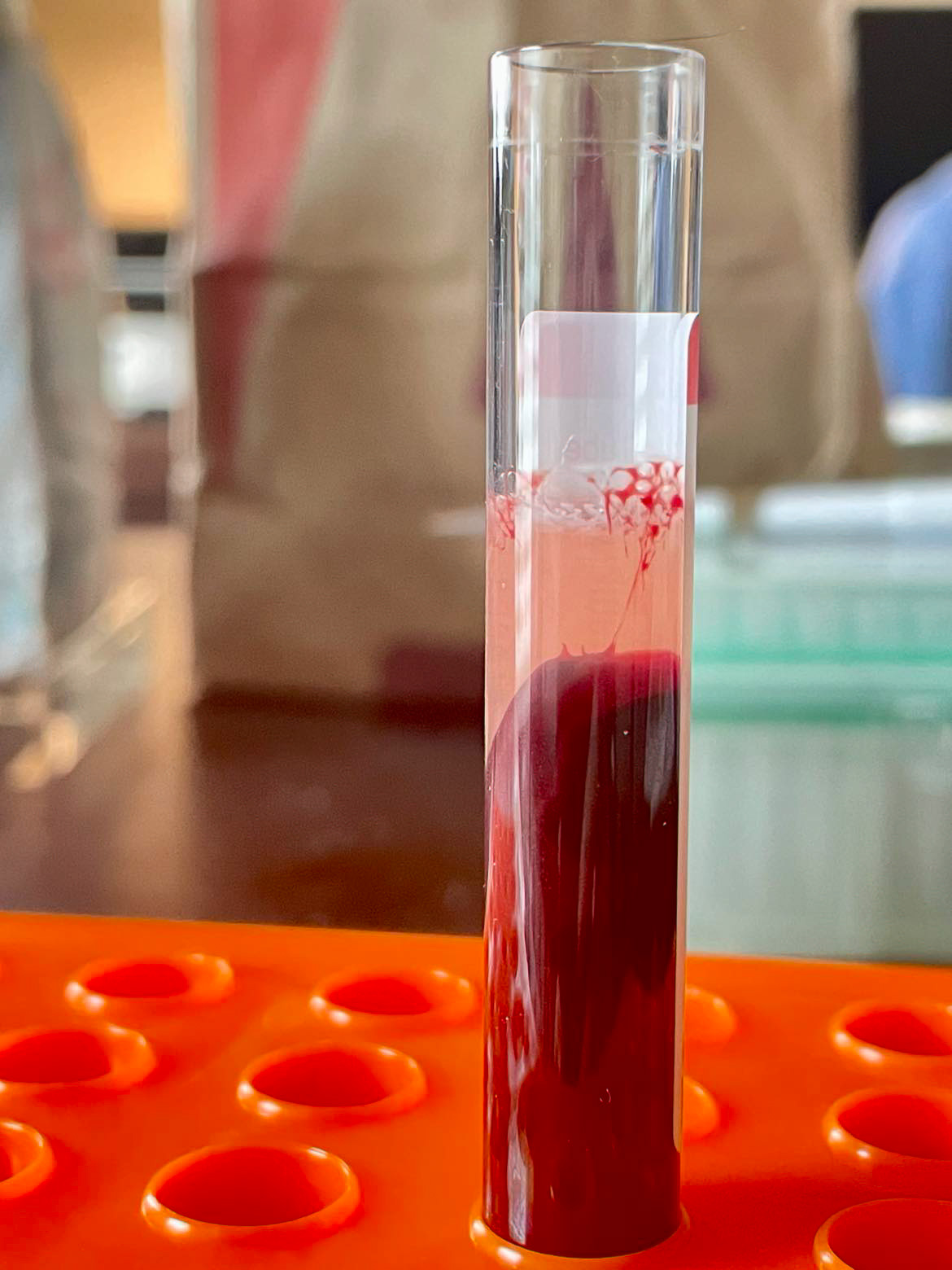 Serum separation from blood